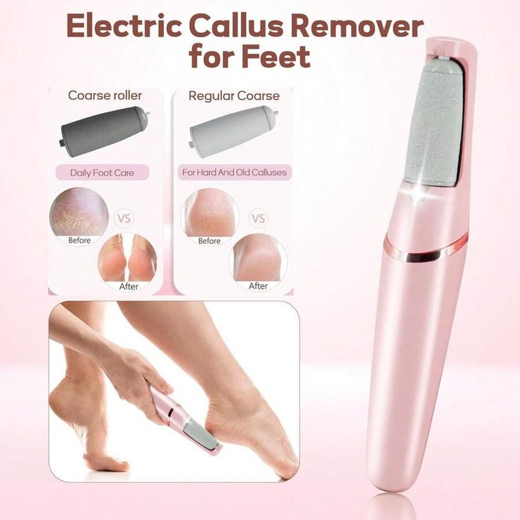 ⚡ Electric Foot File Callus Remover – Rechargeable Pedicure & Heel Care Tool