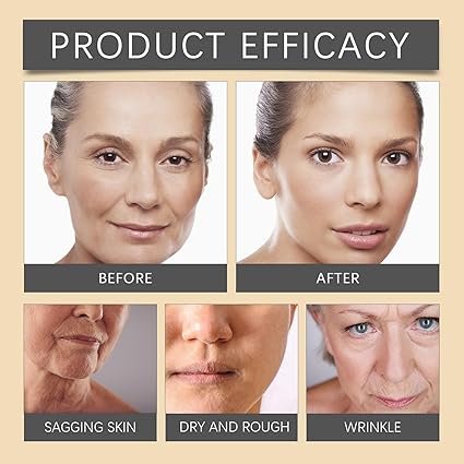 ✨ OUHOE Bee Venom Wrinkle Cream – Anti-Aging Face Moisturizer & Firming Cream