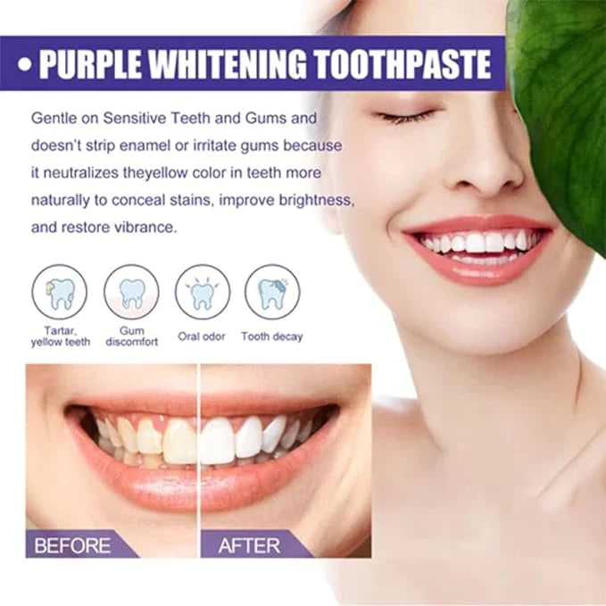 💜 Purple Teeth Whitening Toothpaste – Stain Removal & Instant Bright Smile