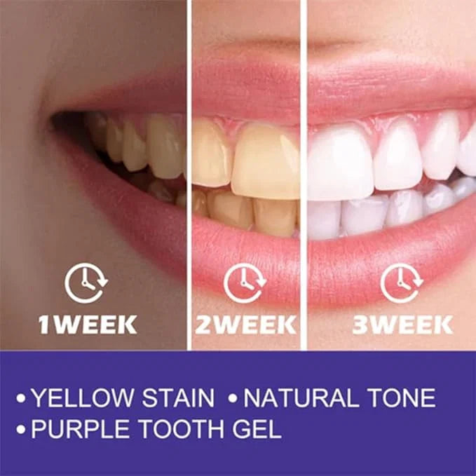 💜 Purple Teeth Whitening Toothpaste – Stain Removal & Instant Bright Smile